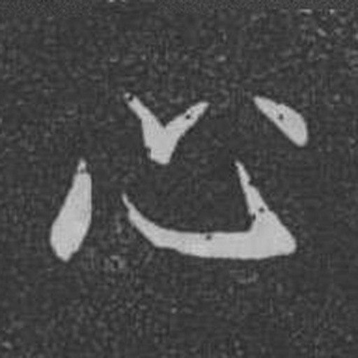 心